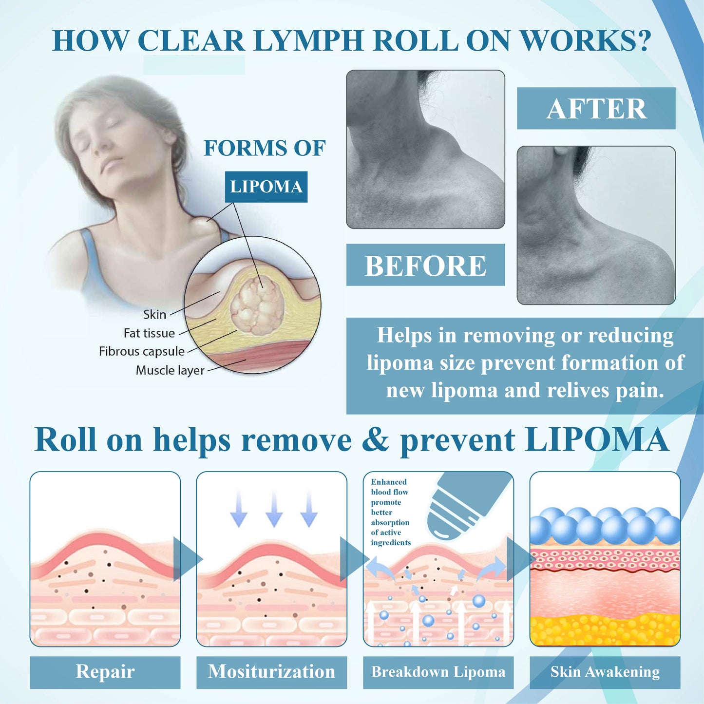 NEGUSY™ Lumps Clear Lymph Support Roll-On