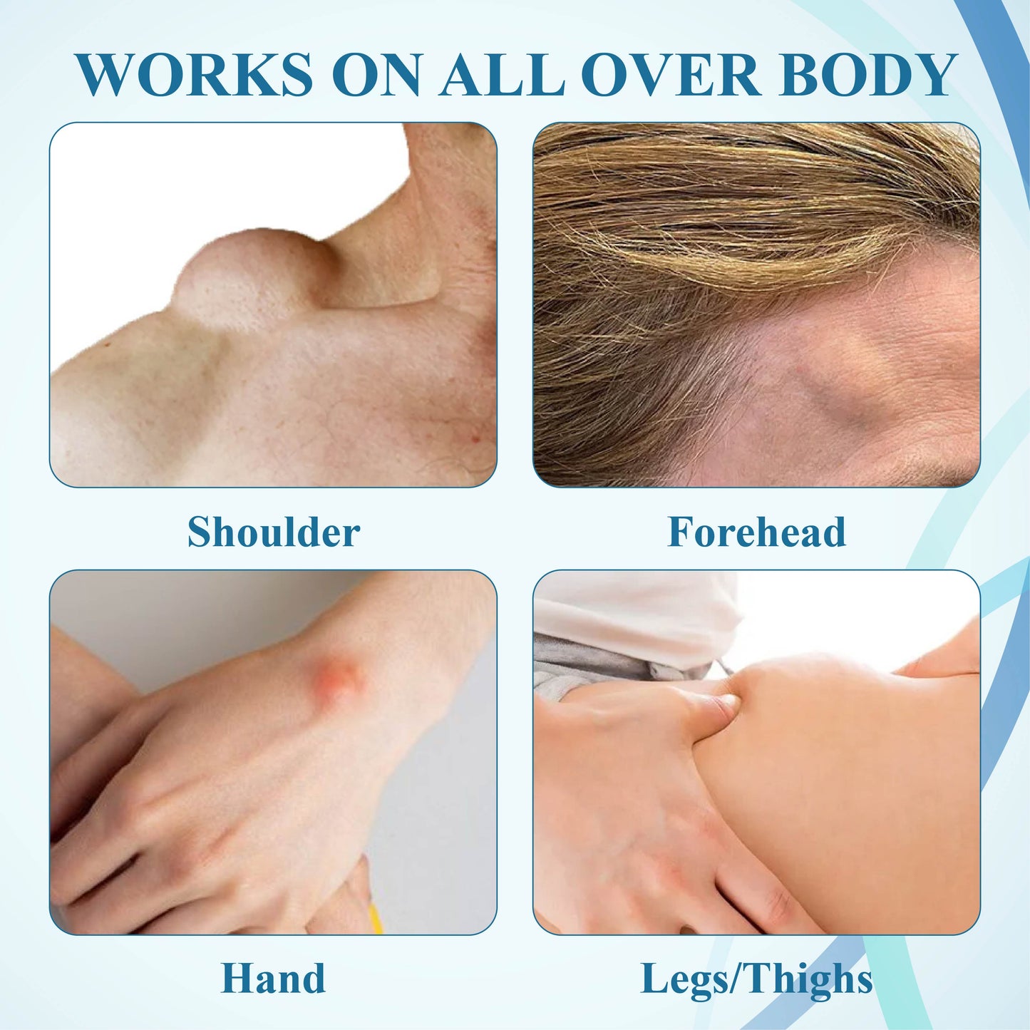 NEGUSY™ Lumps Clear Lymph Support Roll-On
