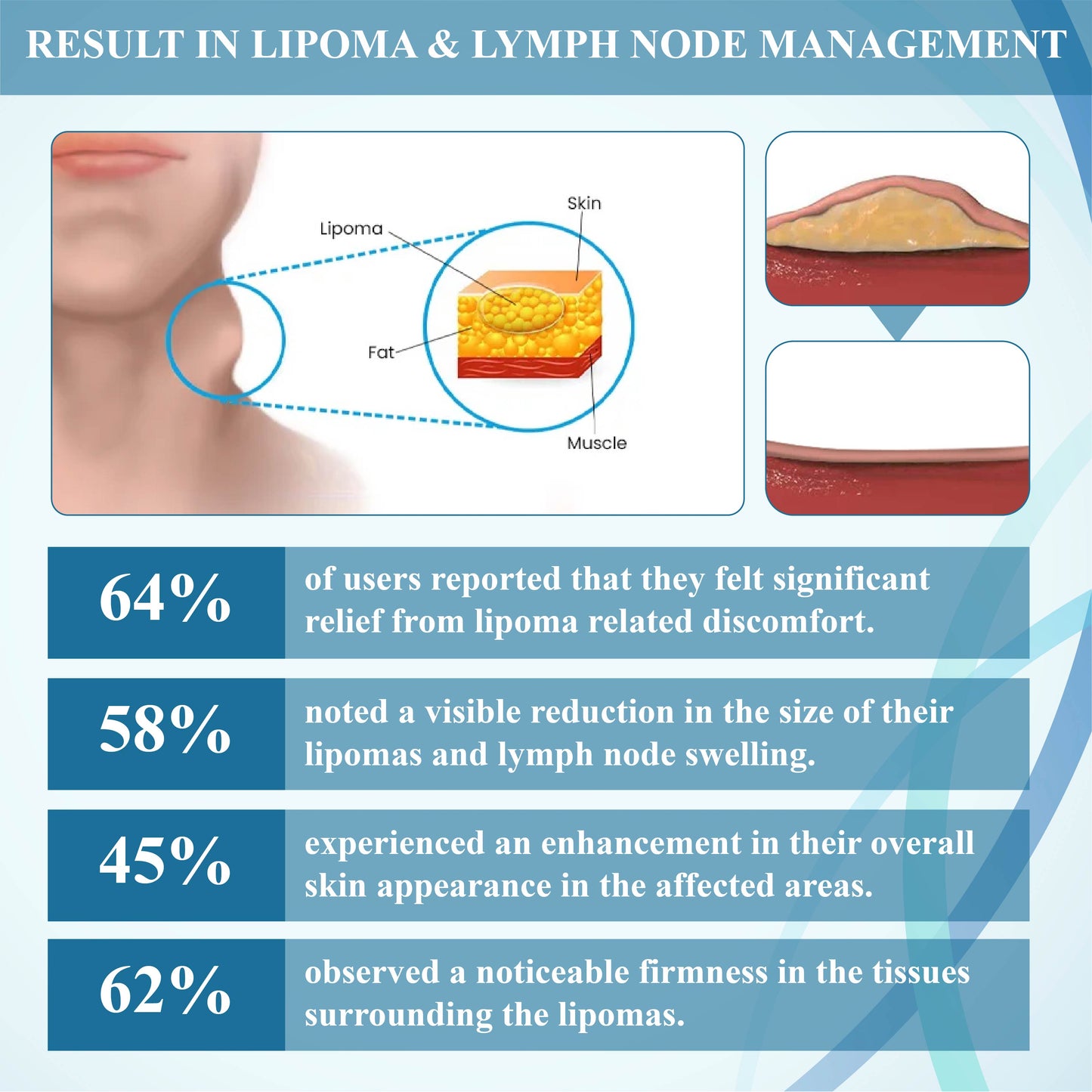 NEGUSY™ Lumps Clear Lymph Support Roll-On