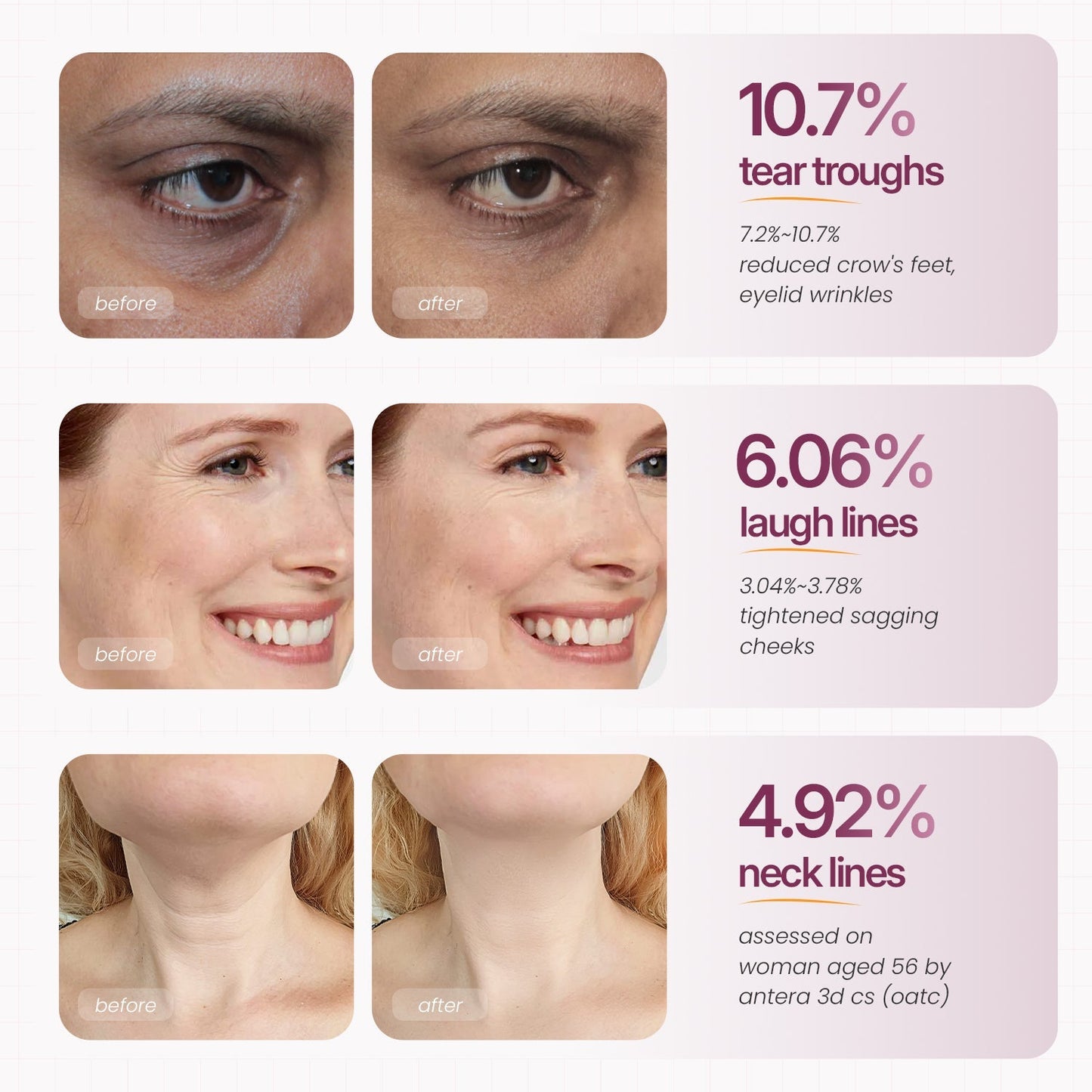 🏆 #1 Bestselling🏆--Cemenrete Calcium Multi Balm 💫 Anti-Aging & Firming Korean Skincare Stick🔥