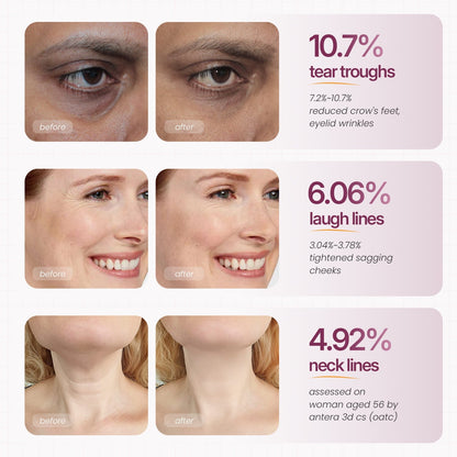 🏆 #1 Bestselling🏆--Cemenrete Calcium Multi Balm 💫 Anti-Aging & Firming Korean Skincare Stick🔥
