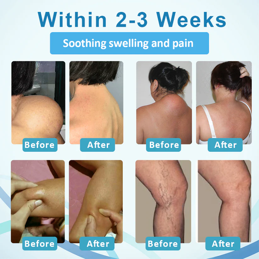 NEGUSY™ Lumps Clear Lymph Support Roll-On