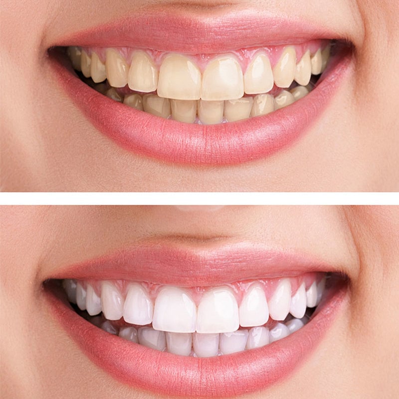 Hydroxyapatite Toothpaste🦷( FDA recommended)(🎁FlashSale - Don't Miss Out)