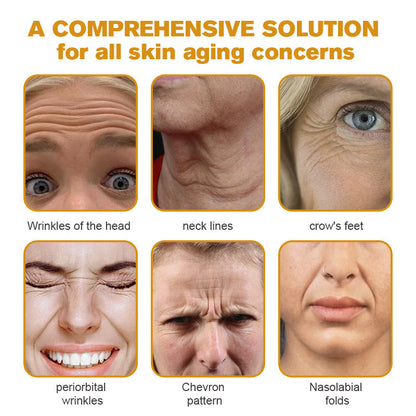 🔥Flash Sale - ODALIT™ Botox Bee Venom Wrinkle Removal Cream🐝