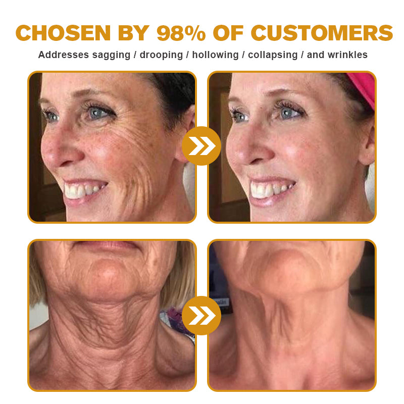 🔥Flash Sale - ODALIT™ Botox Bee Venom Wrinkle Removal Cream🐝