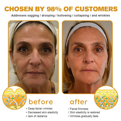 🔥Flash Sale - ODALIT™ Botox Bee Venom Wrinkle Removal Cream🐝
